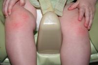 Ouch!  Crawling is hard on the knees..