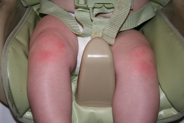 Ouch!  Crawling is hard on the knees..