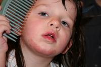 02102009JoleighHurtChin